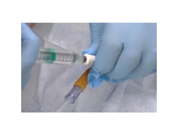 Catheter Care including Bladder Washout